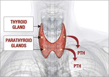 Unhealthy Parathyroid Glands